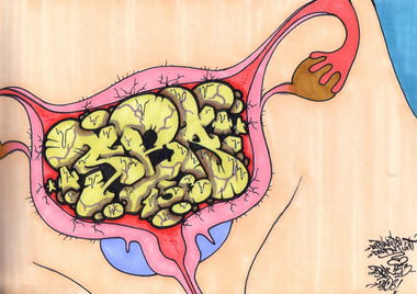 Graffiti Sketch in Frankfurt (Oder) - Photo by spoare153 - 2008 (spoa)